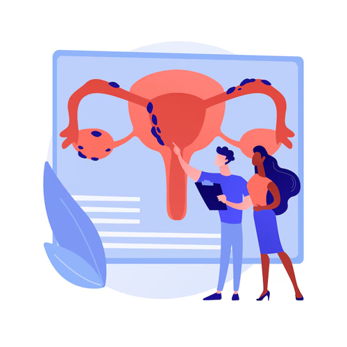 PCOS Treatment